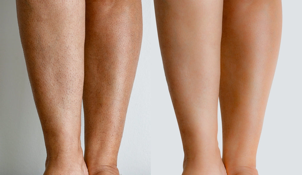 Painless Cream Wax + Strip Pack ( Free )