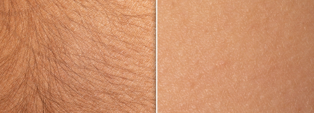 Painless Cream Wax + Strip Pack ( Free )