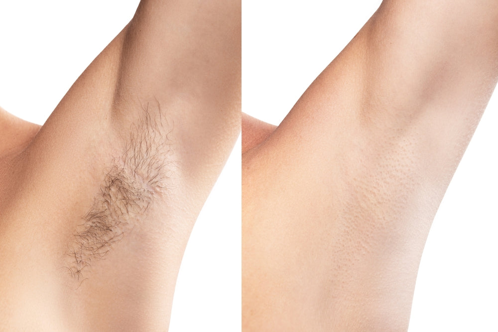 Painless Cream Wax + Strip Pack ( Free )