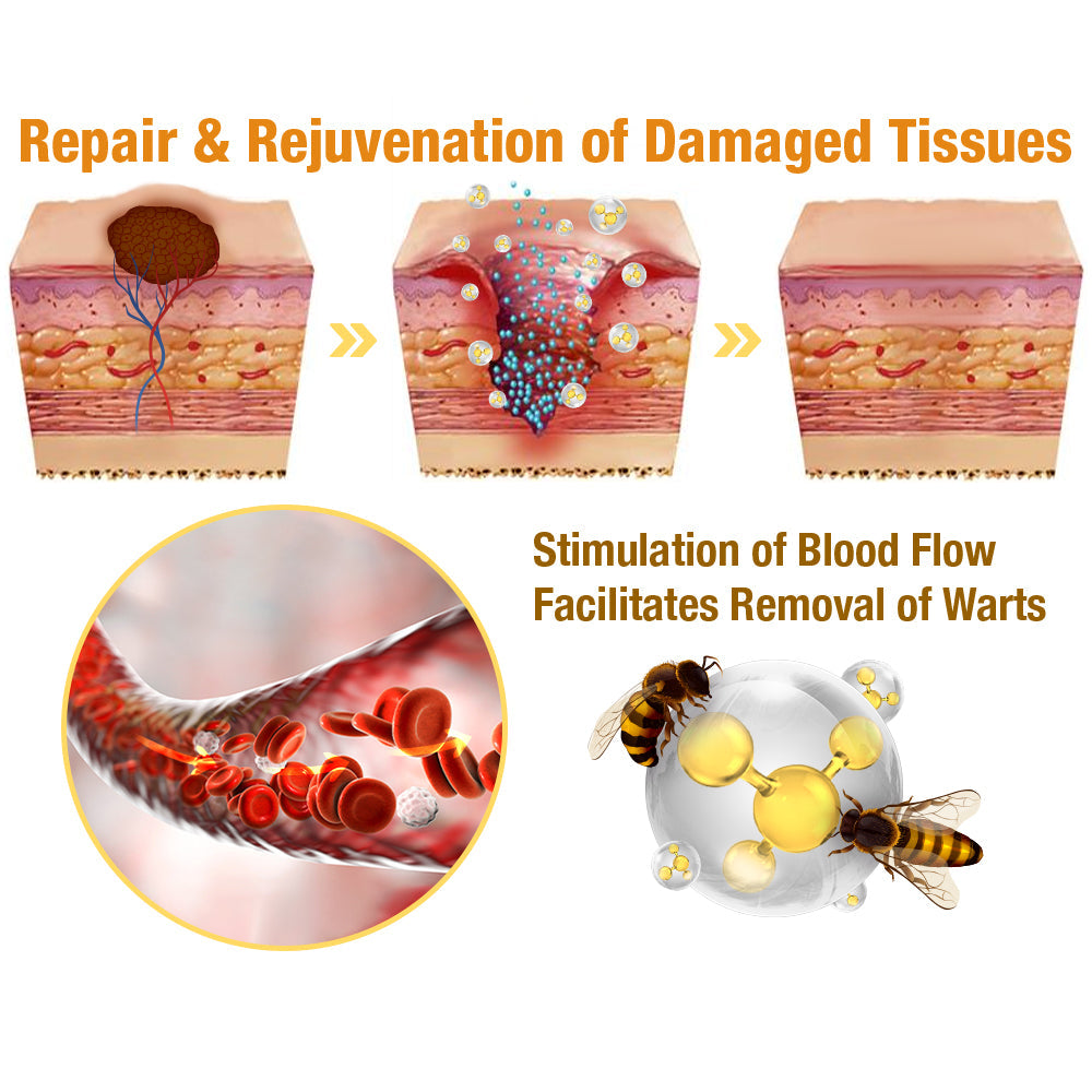 TagAway | Effective removal of warts and skin growths